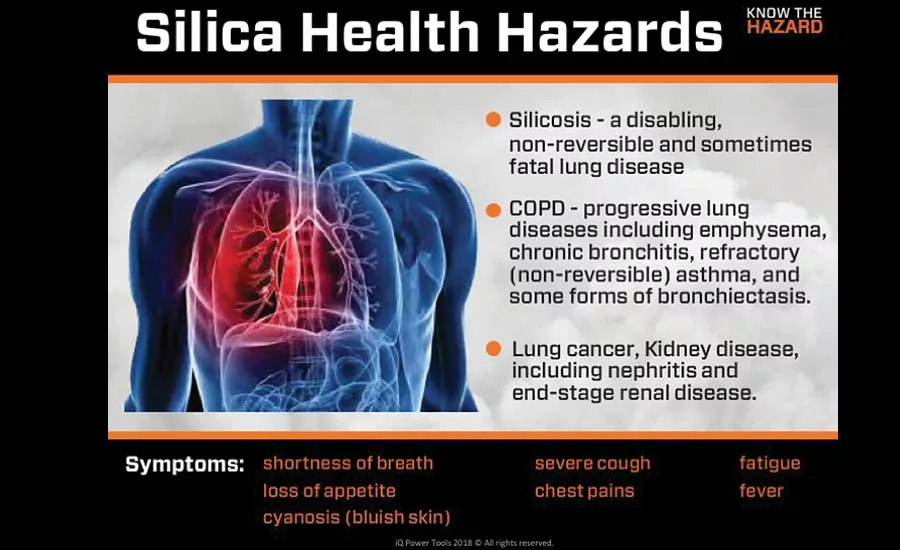 Silicosis can cause fatal diseases