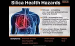 Silicosis can cause fatal diseases